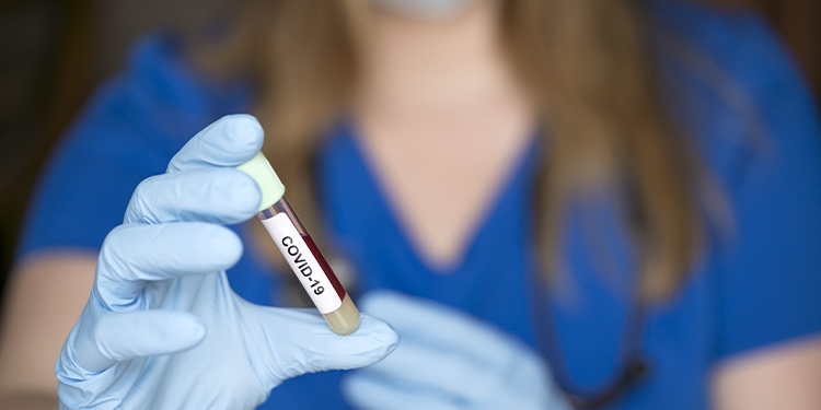 Pelo menos 190 pessoas morreram de covid-19 em casa no Rio Grande do Norte