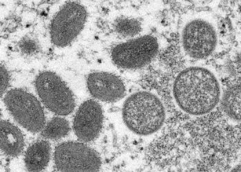 Brasil já confirmou mais de 200 casos de varíola dos macacos