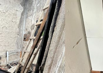 Homem sofre fortes queimaduras no corpo após dormir com cigarro aceso