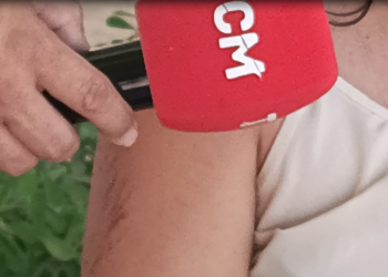 Mulher vítima de atropelamento e pedradas pelo ex-companheiro diz que tem medo de ser morta