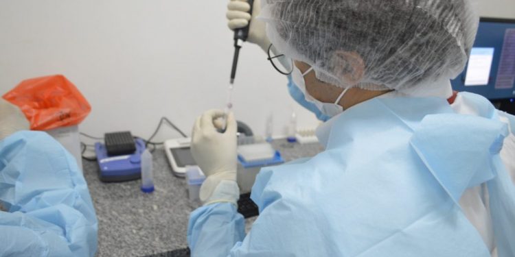 Lacen passa a fazer o diagnóstico da monkeypox no RN