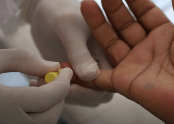 Laboratório da UFRN desenvolve novo teste rápido para sífilis com universidades internacionais