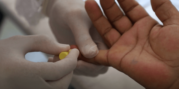 Laboratório da UFRN desenvolve novo teste rápido para sífilis com universidades internacionais