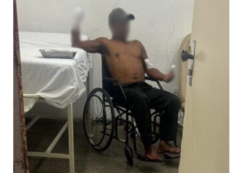 Homem tem mão decepada após discussão em Baraúna