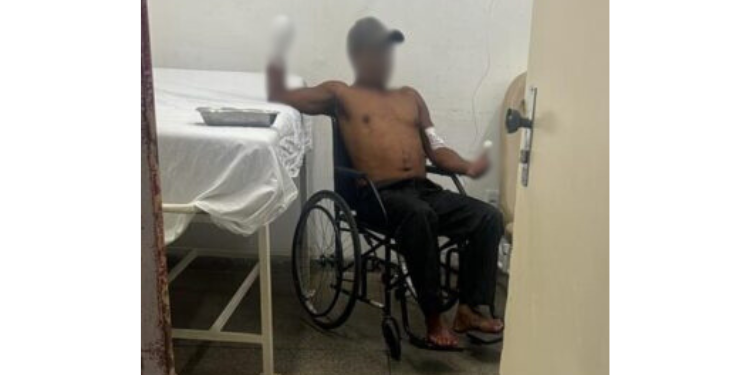 Homem tem mão decepada após discussão em Baraúna
