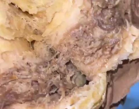 Estudante denuncia larva encontrada dentro de salgado na Uern